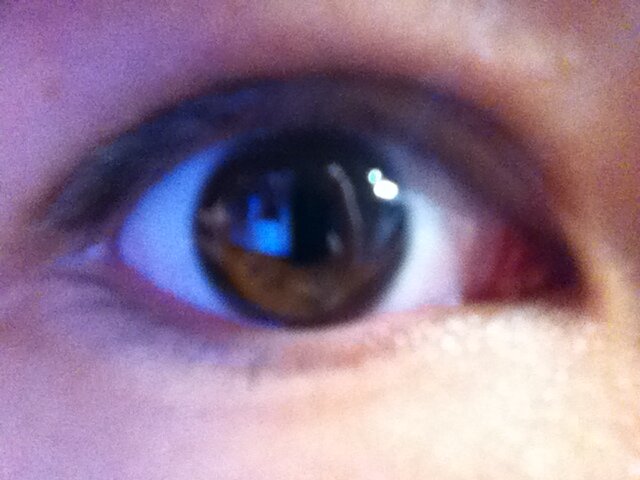 Eye.JPG